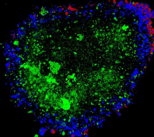 Confocal Microscopy