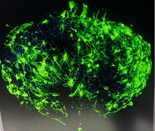 Confocal image of Glioma Organoid