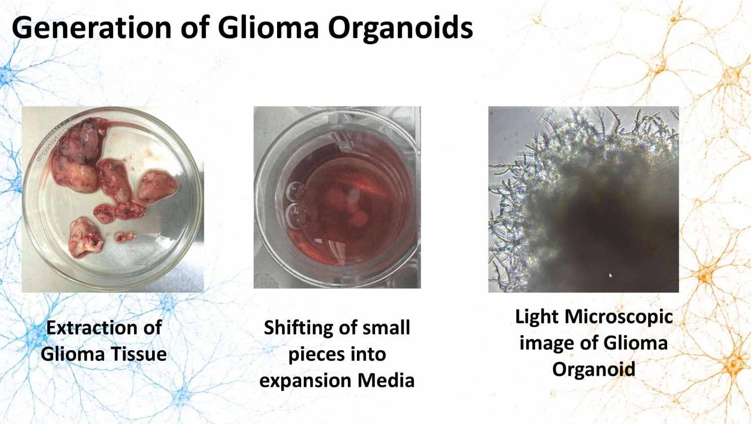 Generation of glioma organoids from glioma tissue