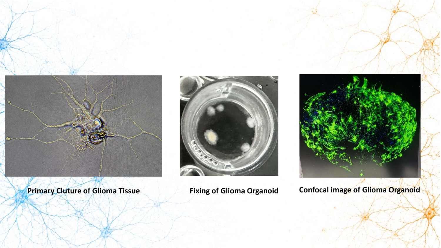Confocal characterization of glioma organoid