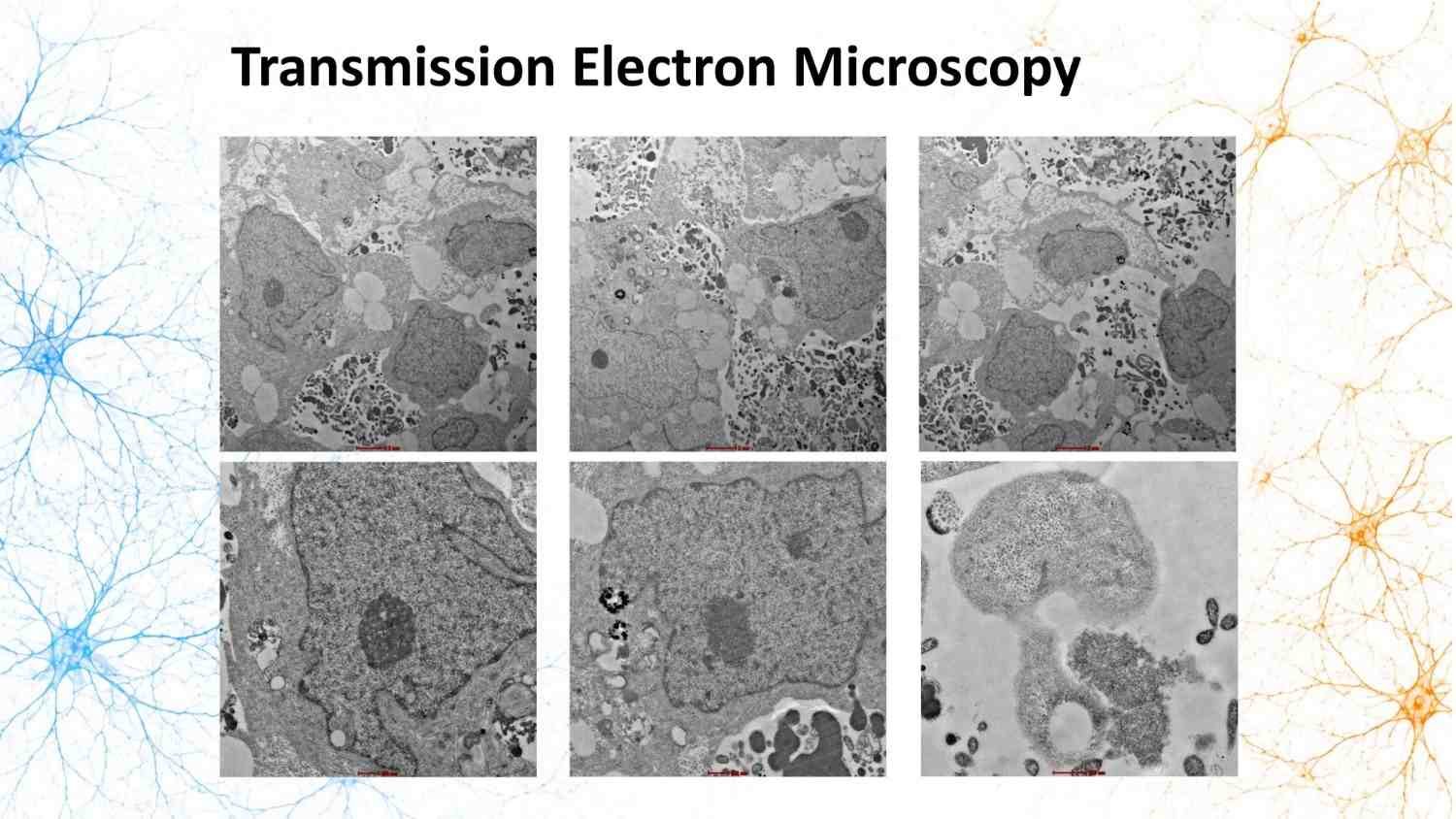 Transmission electron microscopy of brain organoid cellular structures