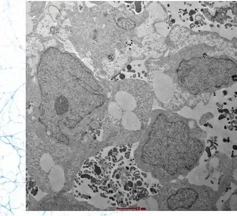 Transmission electron microscopy imaging method