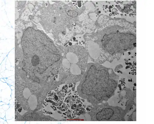 Transmission Electron Microscopy