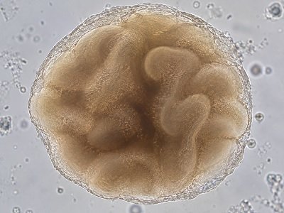 Cerebral organoid research model